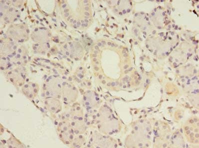 NKIRAS1 Antibody