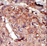 BRD2 / RING3 Antibody (aa170-200)