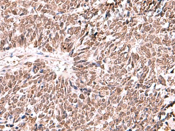 Polyclonal Rabbit anti-Human FDPS Antibody (IHC)