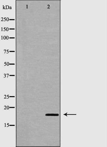 TNNC1 / Cardiac Troponin C Antibody