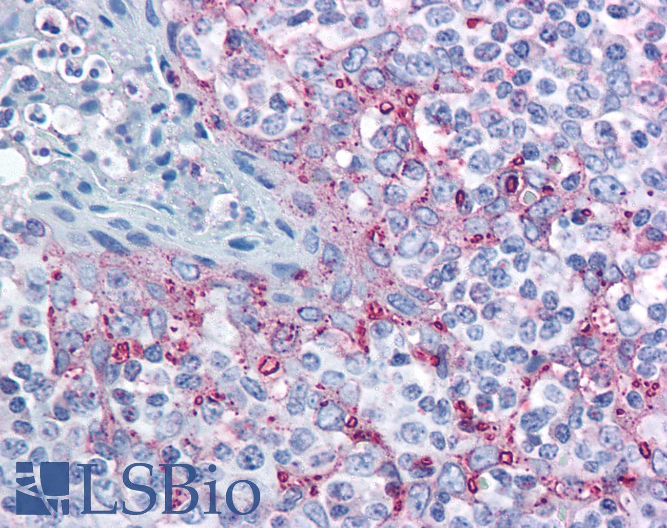 IHC-plus™ MTBP / Mdm2-Binding Protein Antibody