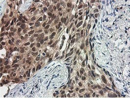 SMS / Spermine Synthase Antibody (clone OTI2G8)