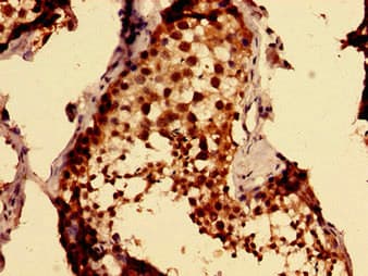 MKRN2 Antibody