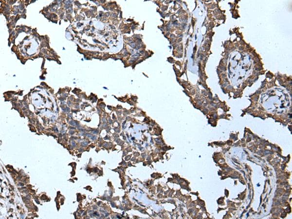 Polyclonal Rabbit anti-Human MCM10 Antibody (IHC)