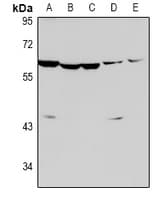 CASP8 / Caspase 8 Antibody