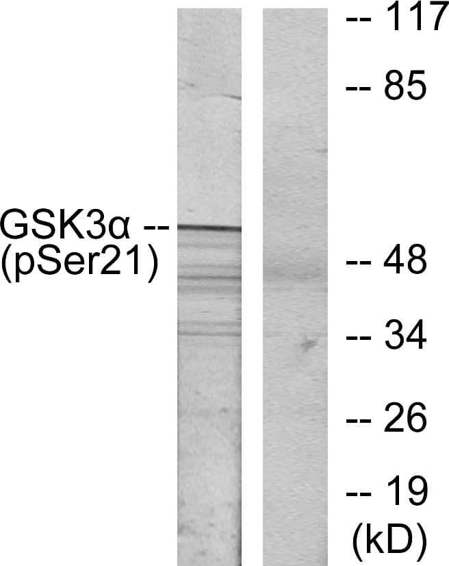 Polyclonal Rabbit anti-Human GSK3A / GSK3 Alpha Antibody (phospho-Ser21, IHC, WB)