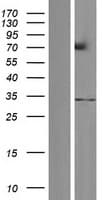 RNF212 Protein (Over-Expression Lysate Myc-DDK (Flag))
