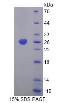 Mouse CHRNA4 / NACHR Protein (Recombinant His-T7)