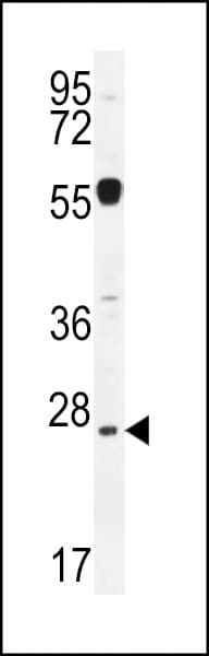 Polyclonal Rabbit anti-Human NIPSNAP3A Antibody (aa74-102, IHC, WB)