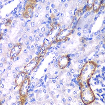 Polyclonal Rabbit anti-Human MYO1C Antibody (IHC, IF, WB)