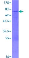 Human HNRNPD / AUF1 Protein (Recombinant GST)