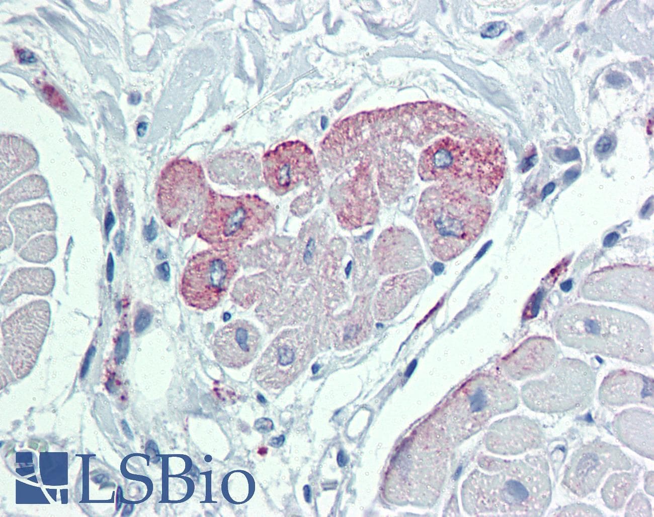 TRPM2 Antibody (aa431-480)