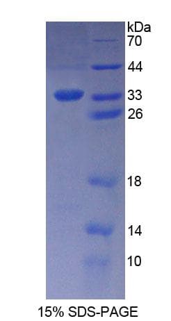 Human KATNA1 Protein (Recombinant His-T7)