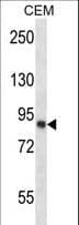 CAPN11 / Calpain 11 Antibody (aa409-438)