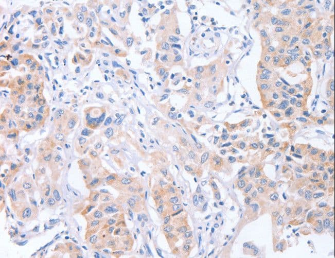 CDCA4 Antibody