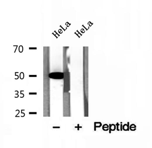 GLUD1/Glutamate Dehydrogenase Antibody
