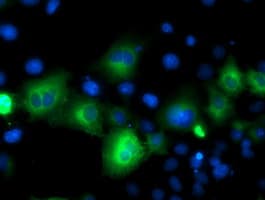 Monoclonal Mouse anti-Human ATG3 Antibody (clone OTI2C12, IHC, IF, WB)