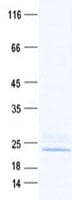 Human Xg Bood Group Protein (Recombinant His, N-Terminal)