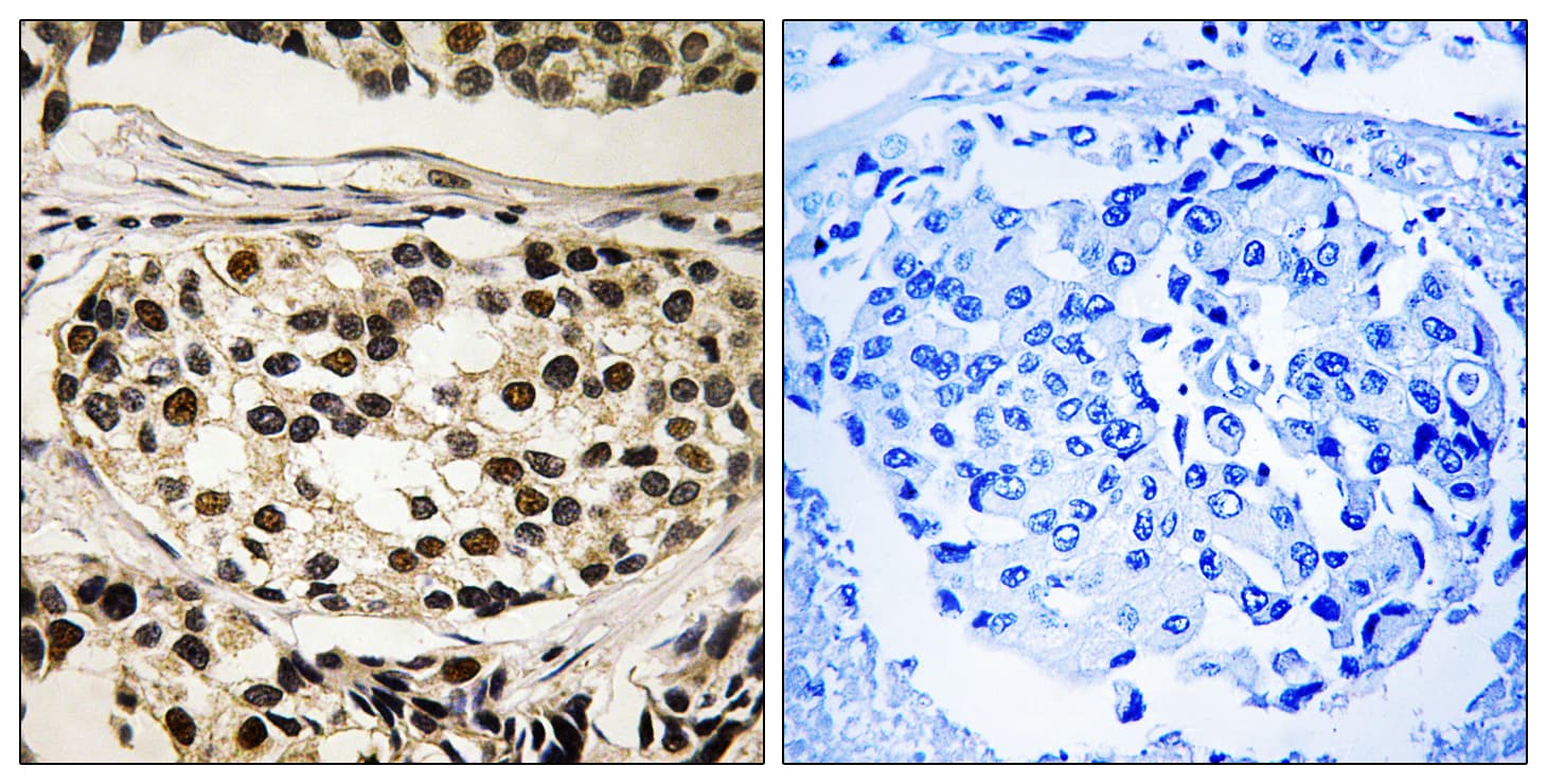 Polyclonal Rabbit anti-Human CCNC / Cyclin C Antibody (phospho-Ser275, IHC, WB)
