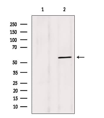 Polyclonal Rabbit anti-Human BBS4 Antibody (IHC, WB)