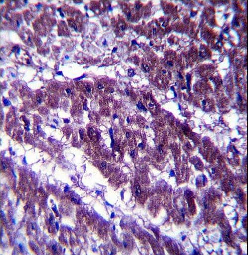 OGDH Antibody (aa381-410)