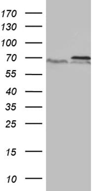 Monoclonal Mouse anti-Human PRMT5 Antibody (clone OTI3E6, aa238-499, WB)