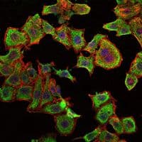 RBP4 Antibody (clone 4C2)