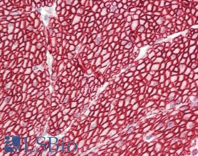 IHC-plus™ GAB2 Antibody (aa104-153)