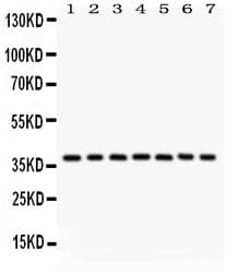 NPM1 / NPM / Nucleophosmin Antibody (aa1-294)