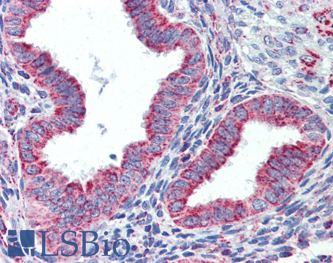 PathPlus™ Polyclonal Goat anti-Human HSPD1 / HSP60 Antibody (IHC, WB)