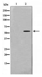 Polyclonal Rabbit anti-Human SRC Antibody (IHC, WB)