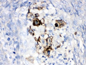 CFB / Complement Factor B Antibody