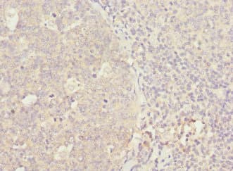 WNT5B Antibody