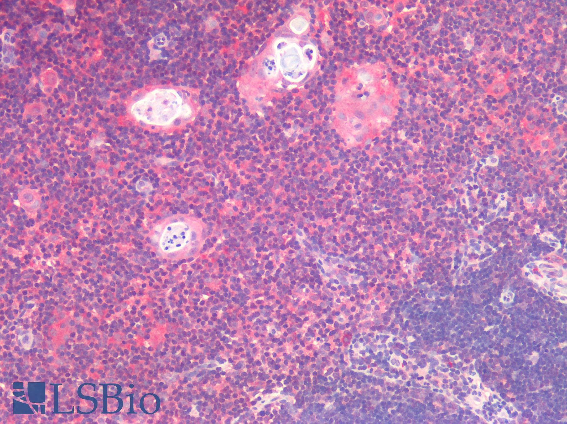 PathPlus™ CD71 / Transferrin Receptor Antibody (clone 1E6)
