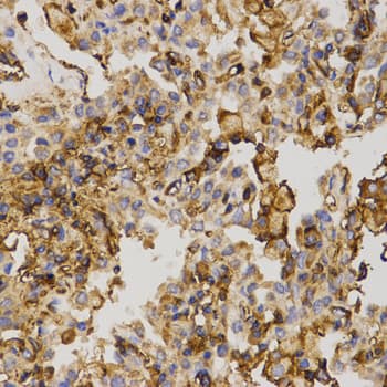 ABCC5 / MRP5 Antibody