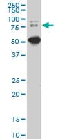 SMIF / DCP1A Antibody (clone 2F11)