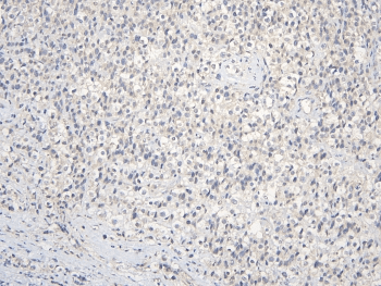 CCDC36 Antibody