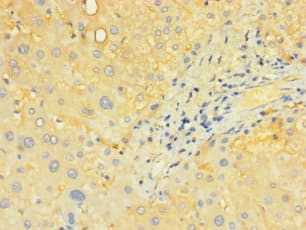 Polyclonal Rabbit anti-Human SLC25A40 Antibody