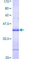 Human NAT2 Protein (Recombinant GST, N-terminus)