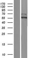 KIAA0141 Protein (Over-Expression Lysate Myc-DDK (Flag))