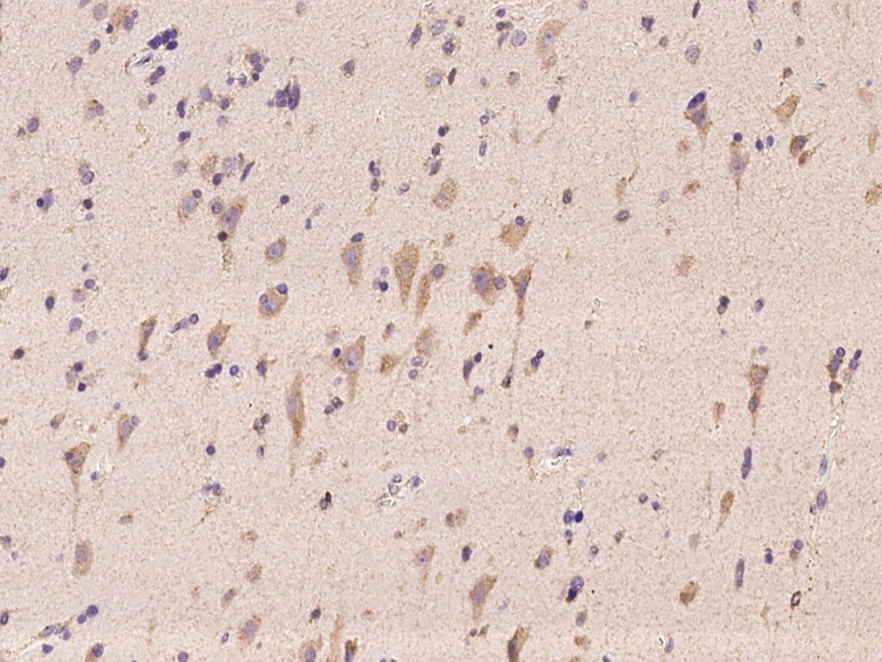 Polyclonal Rabbit anti-Human STYX Antibody (IHC)
