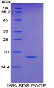 Human CD95 / FAS Protein (Recombinant His)