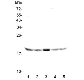 Polyclonal Rabbit anti-Human CR6 / GADD45G Antibody (WB)