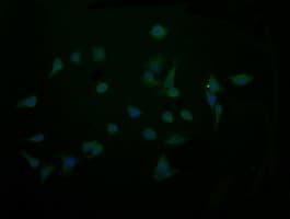 CTAG1B / NY-ESO-1 Antibody (clone OTI4B11, Carrier-free)