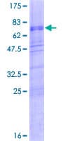 Human MATH2 / NEUROD6 Protein (Recombinant GST)