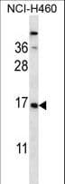 Polyclonal Rabbit anti-Human CSRP2 Antibody (aa68-96, IHC, WB)
