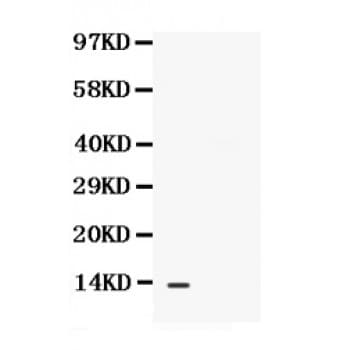 Polyclonal Rabbit anti-Human BLC / CXCL13 Antibody (aa23-109, IHC, WB)