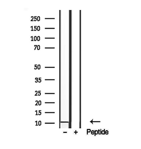 Polyclonal Rabbit anti-Human BCMP84 / S100A14 Antibody (IHC, WB)