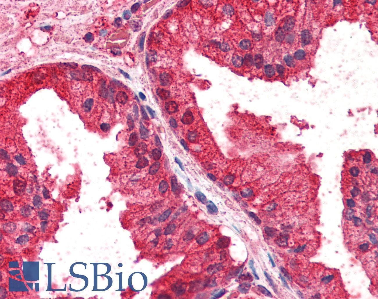 IHC-plus™ Polyclonal Goat anti-Human CREB3L4 / AIBZIP Antibody (aa382-395, IHC, WB)