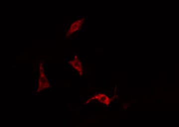 EPS15 Antibody (phospho-Tyr849)